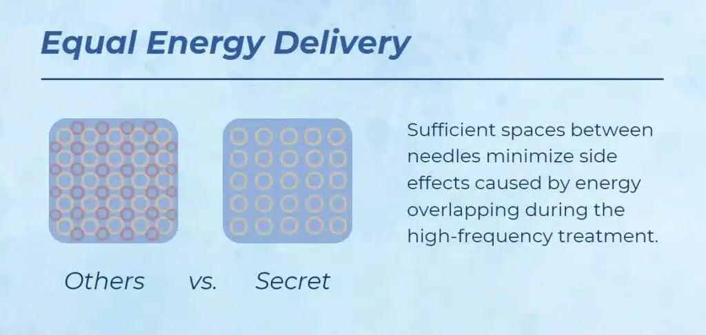 Equal-Energy-Delivery | Seattle Aesthetics | Seattle