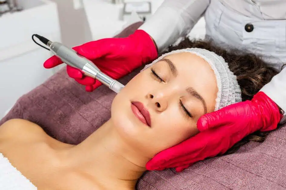 Microneedling in Seattle, WA by RNR Joint Ventures LLC, DBA Seattle Aesthetics